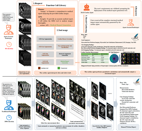 智源发布BAAI Cardiac Agent ：业内首个心脏核磁共振多模态推理诊断智能体