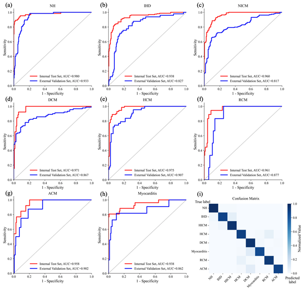 智源发布BAAI Cardiac Agent ：业内首个心脏核磁共振多模态推理诊断智能体